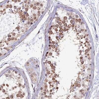 Immunohistochemistry-Paraffin: XKR9 Antibody [NBP1-94164]