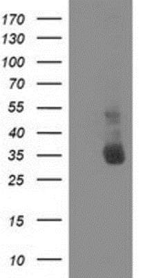 Western Blot: XLF Antibody (OTI3D6) [NBP2-03275]