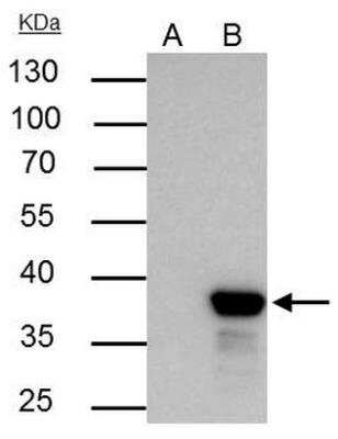 Immunoprecipitation: XLF Antibody [NBP1-31288]