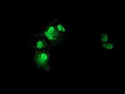 Immunocytochemistry/ Immunofluorescence: XLF Antibody (OTI3D6) - Azide and BSA Free [NBP2-74876]
