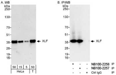 Western Blot: XLF Antibody [NB100-2258]