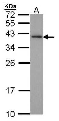 Western Blot: XLF Antibody [NBP1-31288]