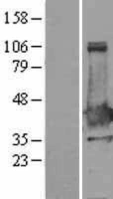 Western Blot: XLF Overexpression Lysate [NBL1-13638]