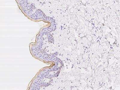 Immunohistochemistry-Paraffin: XP32 Antibody [NBP3-06224]