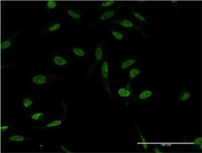 Immunocytochemistry/ Immunofluorescence: XPA Antibody (2E4) [H00007507-M01]