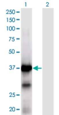 Western Blot: XPA Antibody (2E4) [H00007507-M01]