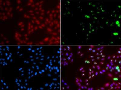 Immunocytochemistry/ Immunofluorescence: XPA Antibody - BSA Free [NBP3-03415]