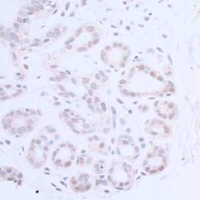 Immunohistochemistry-Paraffin: XPA Antibody [NB100-93321]