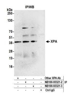 Immunoprecipitation: XPA Antibody [NB100-93321]