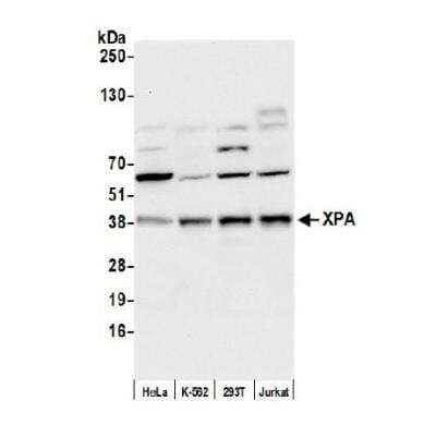 Western Blot: XPA Antibody [NB100-93321]