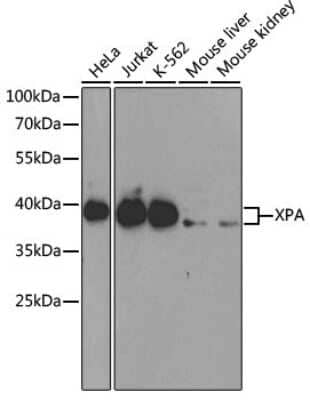 Western Blot: XPA AntibodyBSA Free [NBP3-03415]