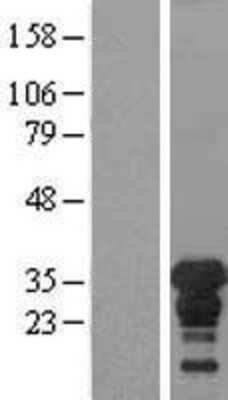 Western Blot: XPA Overexpression Lysate [NBL1-17907]