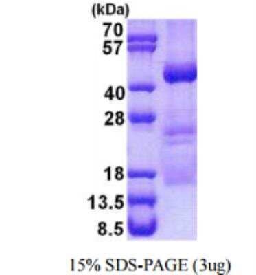 SDS-PAGE: Recombinant Human XPA His Protein [NBP2-22951]