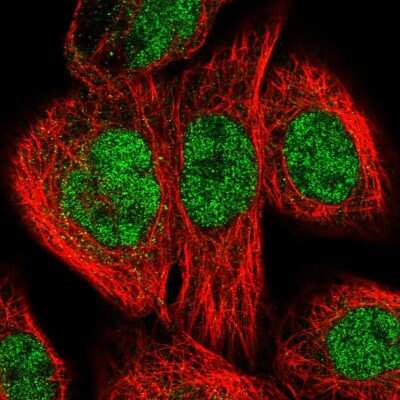 Immunocytochemistry/ Immunofluorescence: XPB Antibody [NBP2-58758]