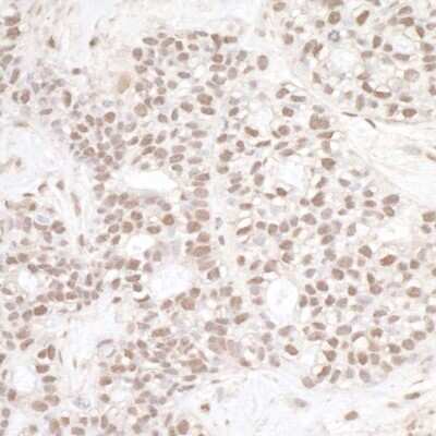 Immunohistochemistry-Paraffin: XPB Antibody [NB100-61059]