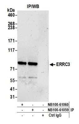 Immunoprecipitation: XPB Antibody [NB100-61059]
