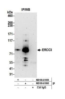 Immunoprecipitation: XPB Antibody [NB100-61060]
