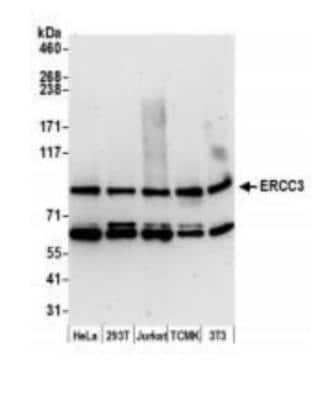 Western Blot: XPB Antibody [NB100-61060]