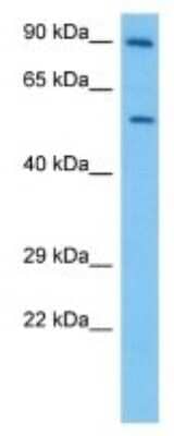 Western Blot: XPB Antibody [NBP3-10102]