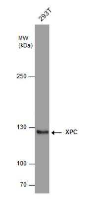 Western Blot: XPC Antibody (3.26) [NB100-477]