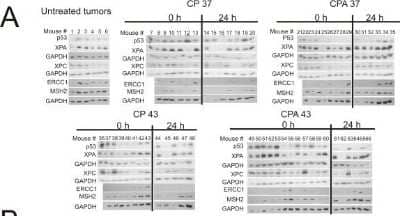 Western Blot: XPC Antibody (3.26) [NB100-477]