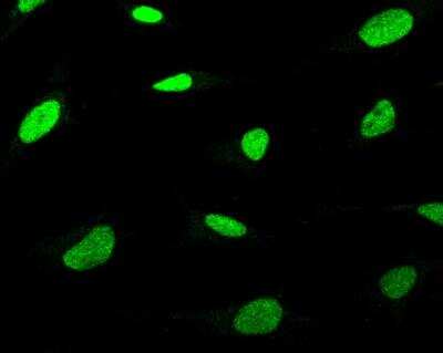 Immunocytochemistry/ Immunofluorescence: XPC Antibody [NBP3-12570]