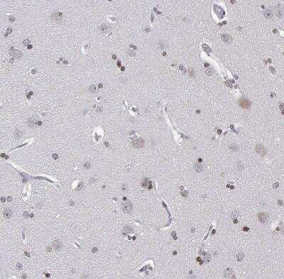Immunohistochemistry-Paraffin: XPC Antibody [NBP2-38261]