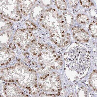 Immunohistochemistry-Paraffin: XPC Antibody [NBP2-38261]