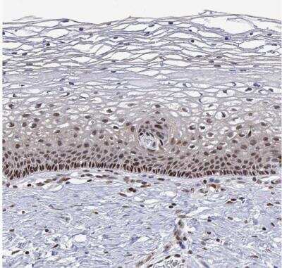 Immunohistochemistry-Paraffin: XPC Antibody [NBP2-38261]