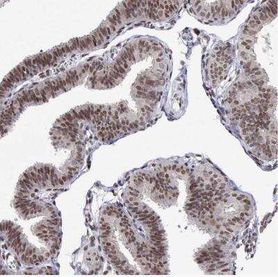 Immunohistochemistry-Paraffin: XPC Antibody [NBP2-38261]
