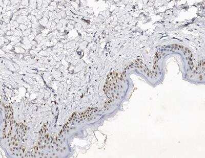 Immunohistochemistry-Paraffin: XPC Antibody [NBP3-12570]