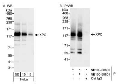 Western Blot: XPC Antibody [NB100-58801]