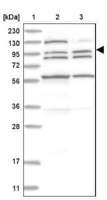 Western Blot: XPC Antibody [NBP2-38261]