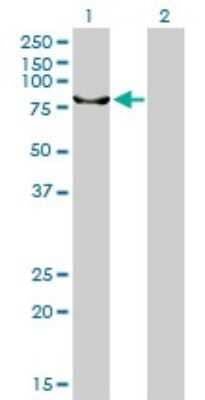 Western Blot: XPD Antibody (4G2-2A6) [H00002068-M01]