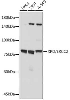 Western Blot: XPD Antibody (6T9K6) [NBP3-15704]