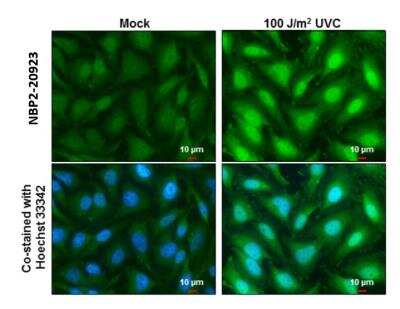 Immunocytochemistry/ Immunofluorescence: XPD Antibody [NBP2-20923]