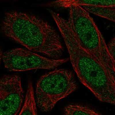 Immunocytochemistry/ Immunofluorescence: XPD Antibody [NBP2-56327]