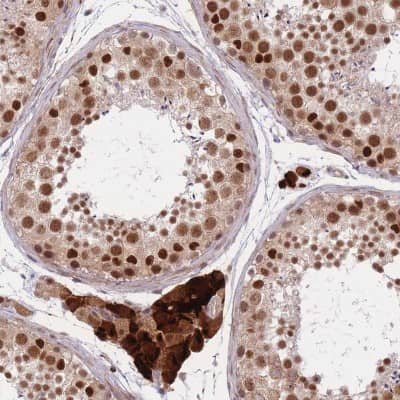 Immunohistochemistry-Paraffin: XPD Antibody [NBP2-38382]