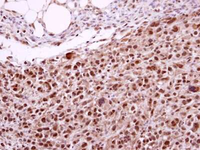 Immunohistochemistry-Paraffin: XPD Antibody [NBP2-20923]