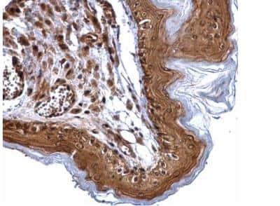 Immunohistochemistry-Paraffin: XPD Antibody [NBP2-20923]
