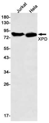 Western Blot: XPD Antibody (S08-2I3) [NBP3-15112]