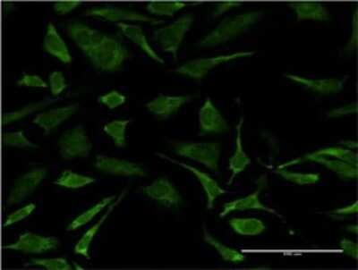 Immunocytochemistry/ Immunofluorescence: XPD Antibody (S3) [H00002068-M04]