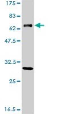 Western Blot: XPD Antibody (S3) [H00002068-M04]