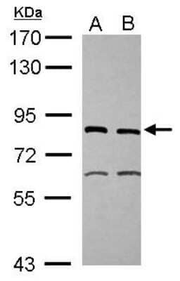 Western Blot: XPD Antibody [NBP2-20923]