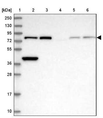 Western Blot: XPD Antibody [NBP2-38382]