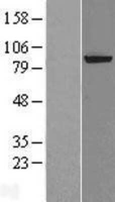 Western Blot: XPD Overexpression Lysate [NBL1-10320]