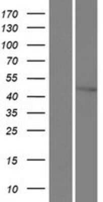 Western Blot: XPD Overexpression Lysate [NBP2-11103]