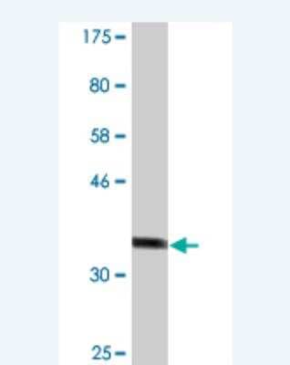 Western Blot: XPE/DDB2 Antibody (1F11) [H00001643-M01]