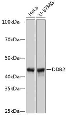 Western Blot: XPE/DDB2 Antibody (4Y2G5) [NBP3-15414]