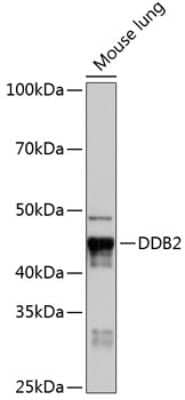 Western Blot: XPE/DDB2 Antibody (4Y2G5) [NBP3-15414]